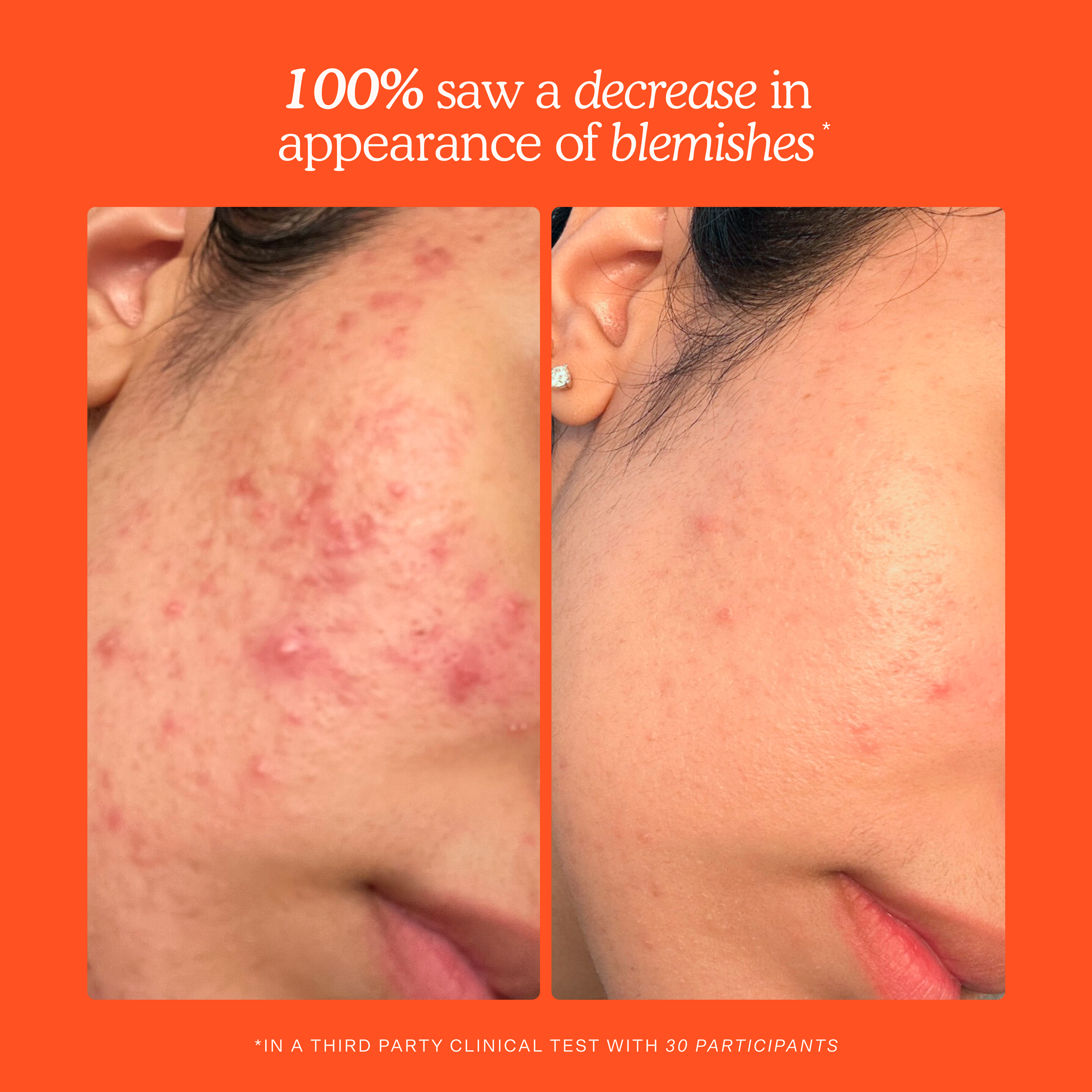 Travel SOS Rescue Spray